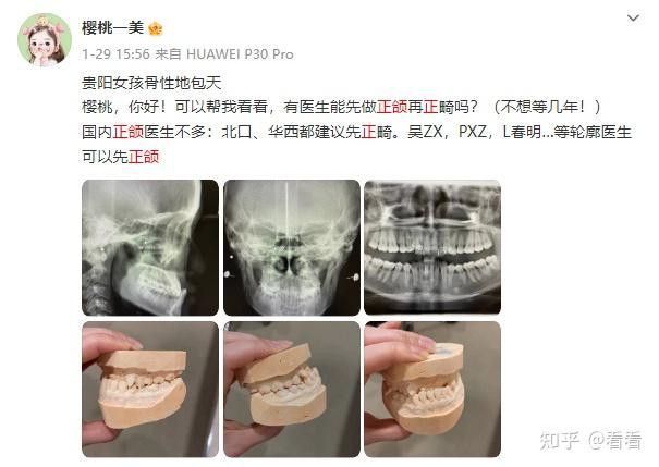 哪些醫院擅長做紅龍魚地包天手術？
