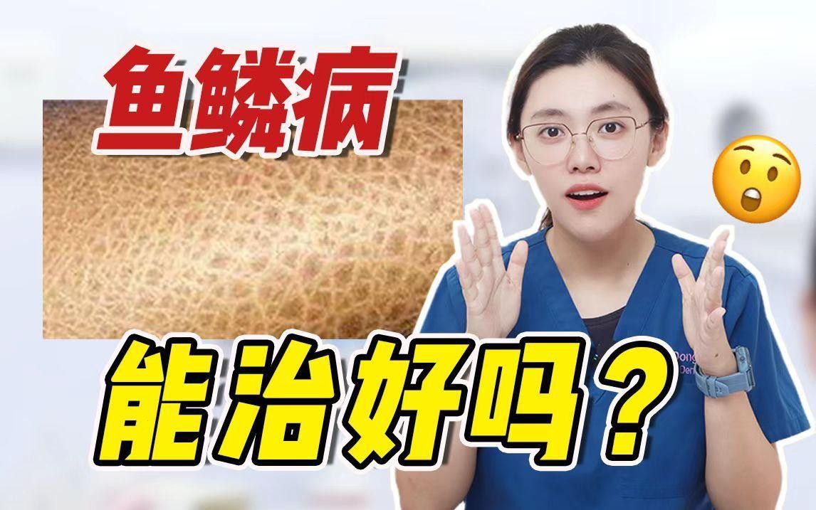 病態脫皮的癥狀有哪些？