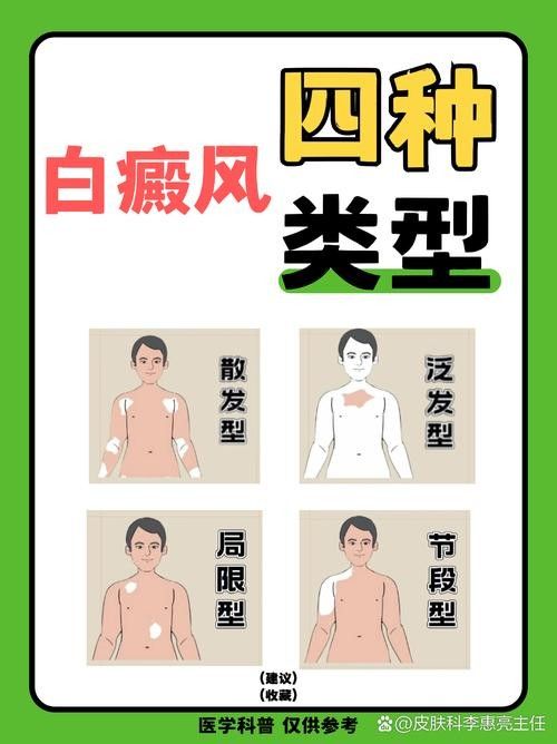 銀龍魚全身發白是什么原因造成的圖片