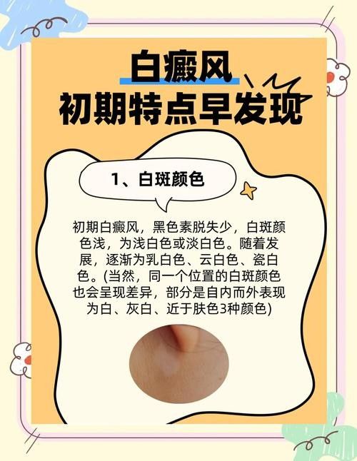 銀龍魚全身發白是什么原因造成的圖片