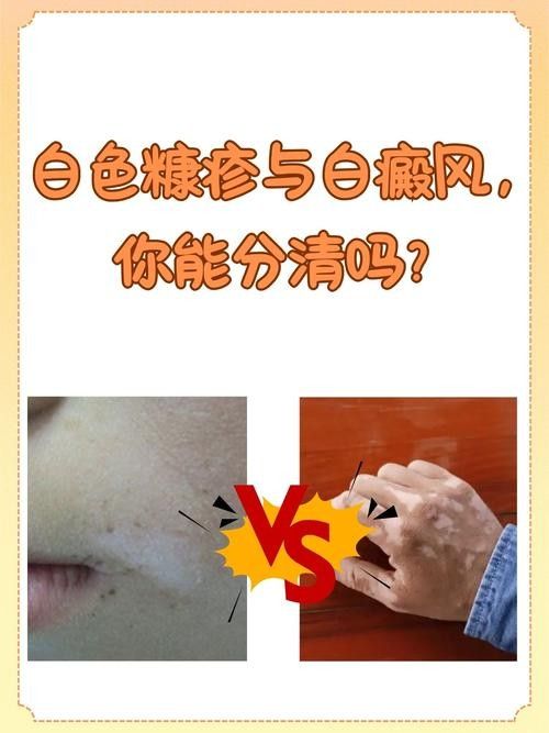 銀龍魚全身發白是什么原因造成的圖片