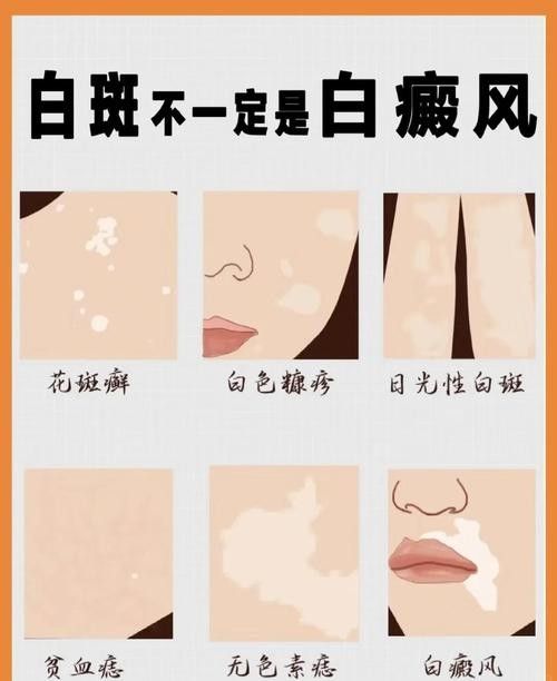 銀龍魚全身發白是什么原因造成的圖片
