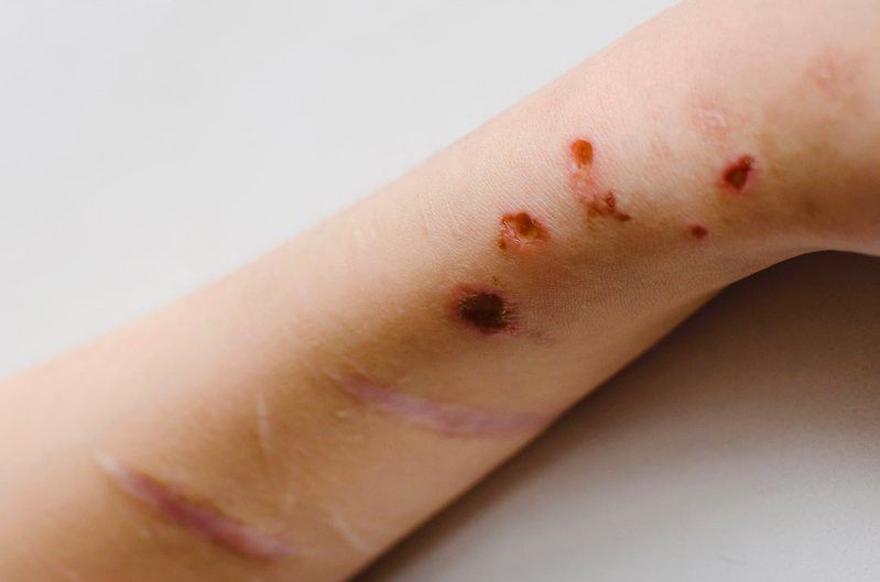 如何判斷龍魚是否感染了傳染性疾病？