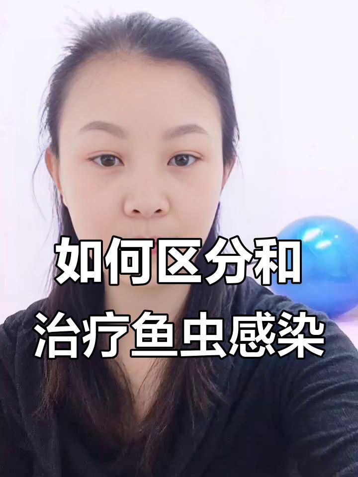 魚有寄生蟲怎么辦用什么藥