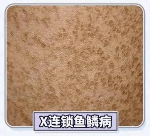 龍魚鱗病圖片對照