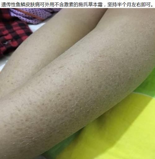 龍魚鱗病圖片對照