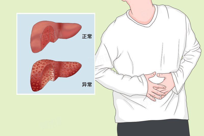腹水癥狀的早期識別