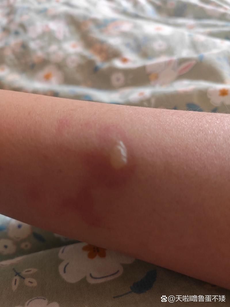 銀龍魚身上起白泡怎么辦圖片