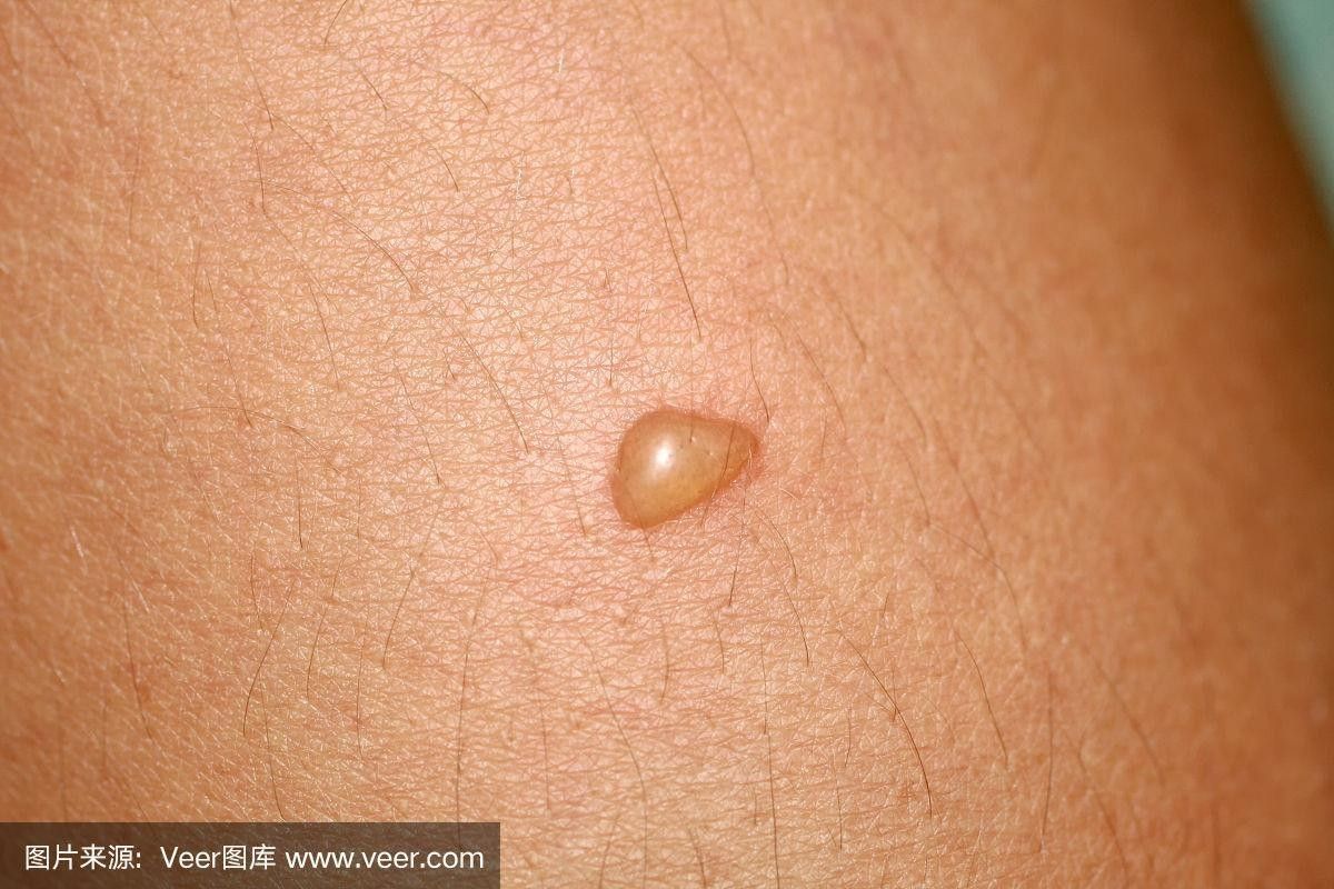 銀龍魚身上起白泡怎么辦圖片