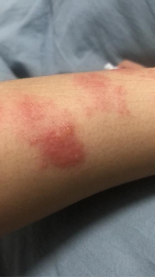 銀龍魚身上起白泡怎么辦圖片