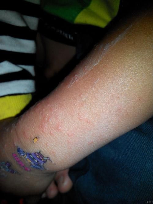 銀龍魚身上起白泡怎么辦圖片