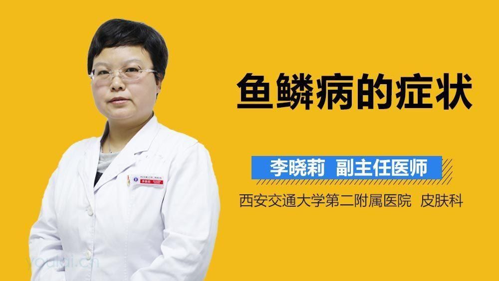 如何判斷自己是否患有魚鱗病？