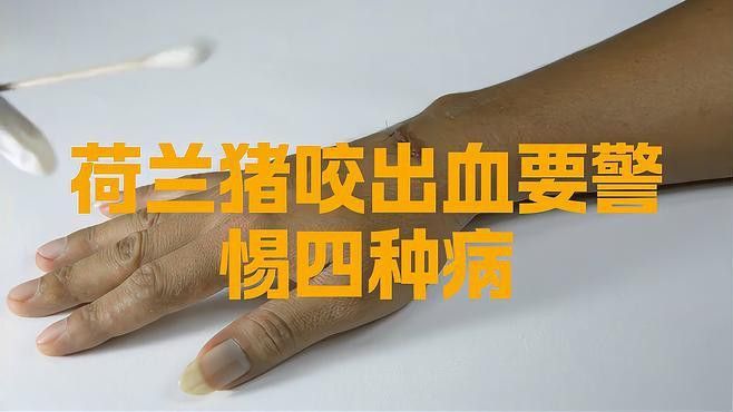 被龍魚咬傷后如何判斷是否感染？