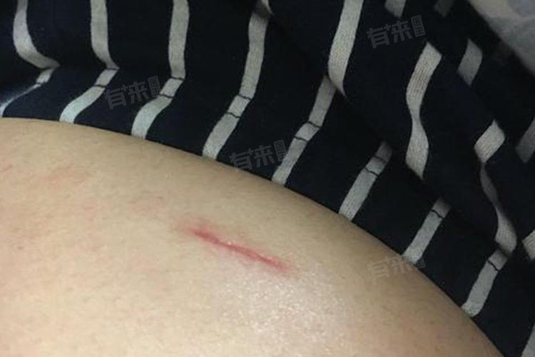 如何判斷龍魚傷口是否完全愈合？