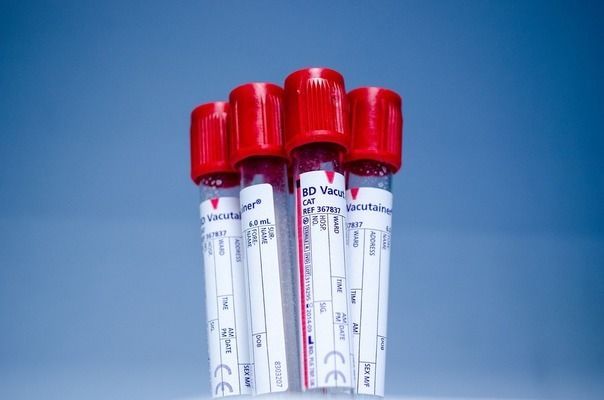 紅龍魚過濾系統推薦：紅龍魚專用過濾器品牌排行