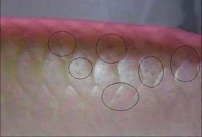 龍魚鱗片充血什么原因：龍魚鱗片充血是什么原因