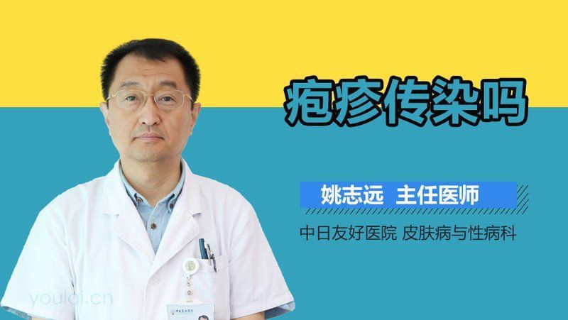 哪種類型的炸鱗病傳染性最強？