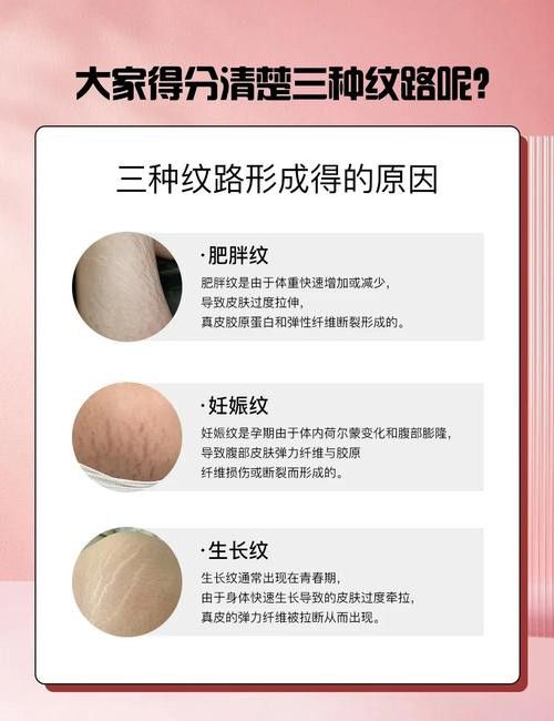 如何通過鱗片底色鑒別真假？