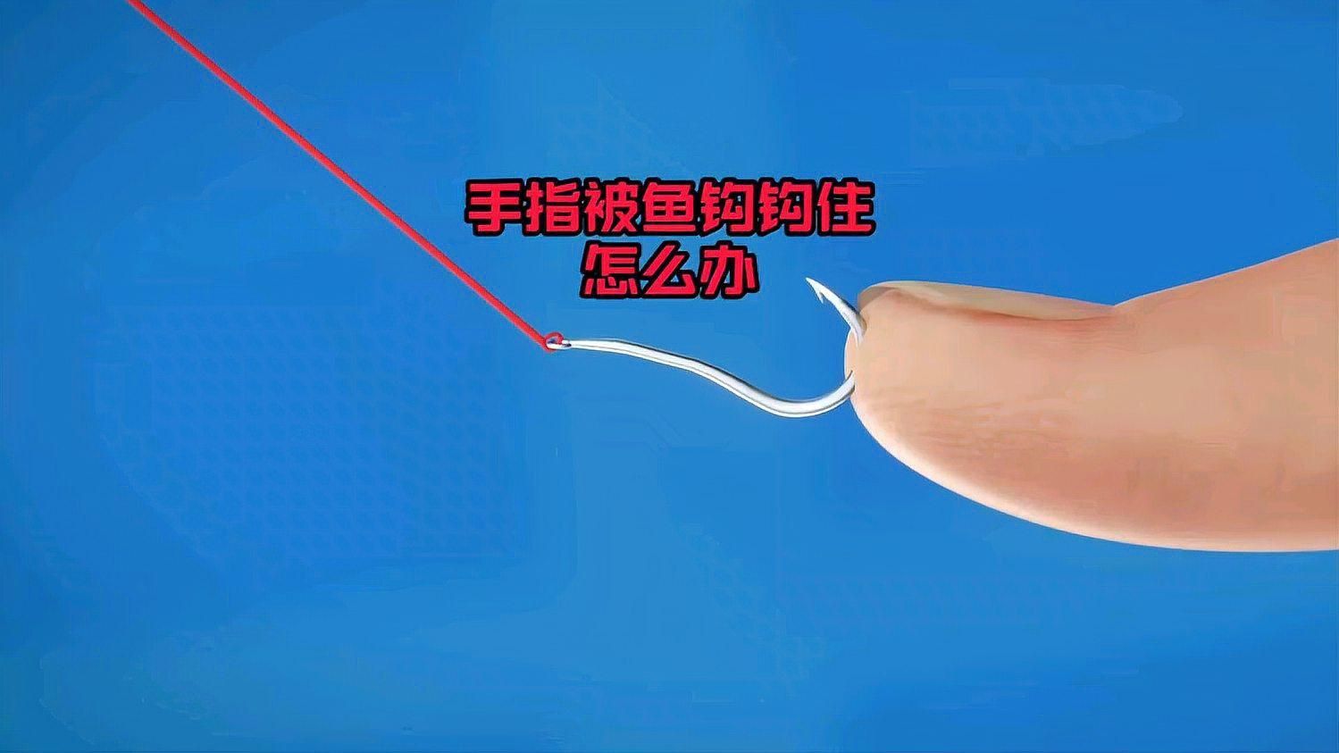 老虎魚扎到手指怎么辦