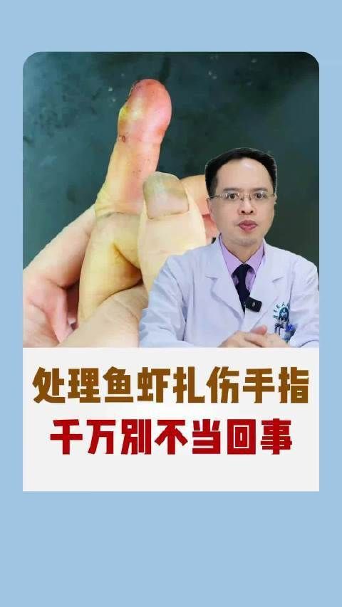 老虎魚扎到手指怎么辦