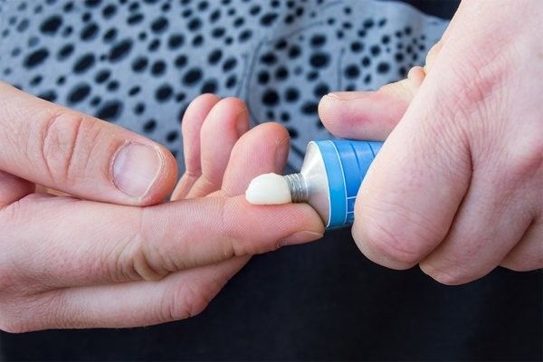 如何正確使用蘆薈膠處理龍魚傷口（如何正確使用蘆薈膠處理龍魚傷口的綜合建議：輕微外傷）