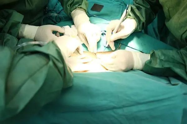 手術費用大概是多少？：做手術為什么貴外科醫生來為你揭秘