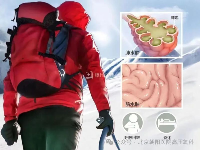 交叉感染期間如何加強(qiáng)溶氧？：“人在高原”該不該吸氧 交叉感染期間如何加強(qiáng)溶氧？：“人在高原”該不該吸氧 龍魚(yú)百科 第3張