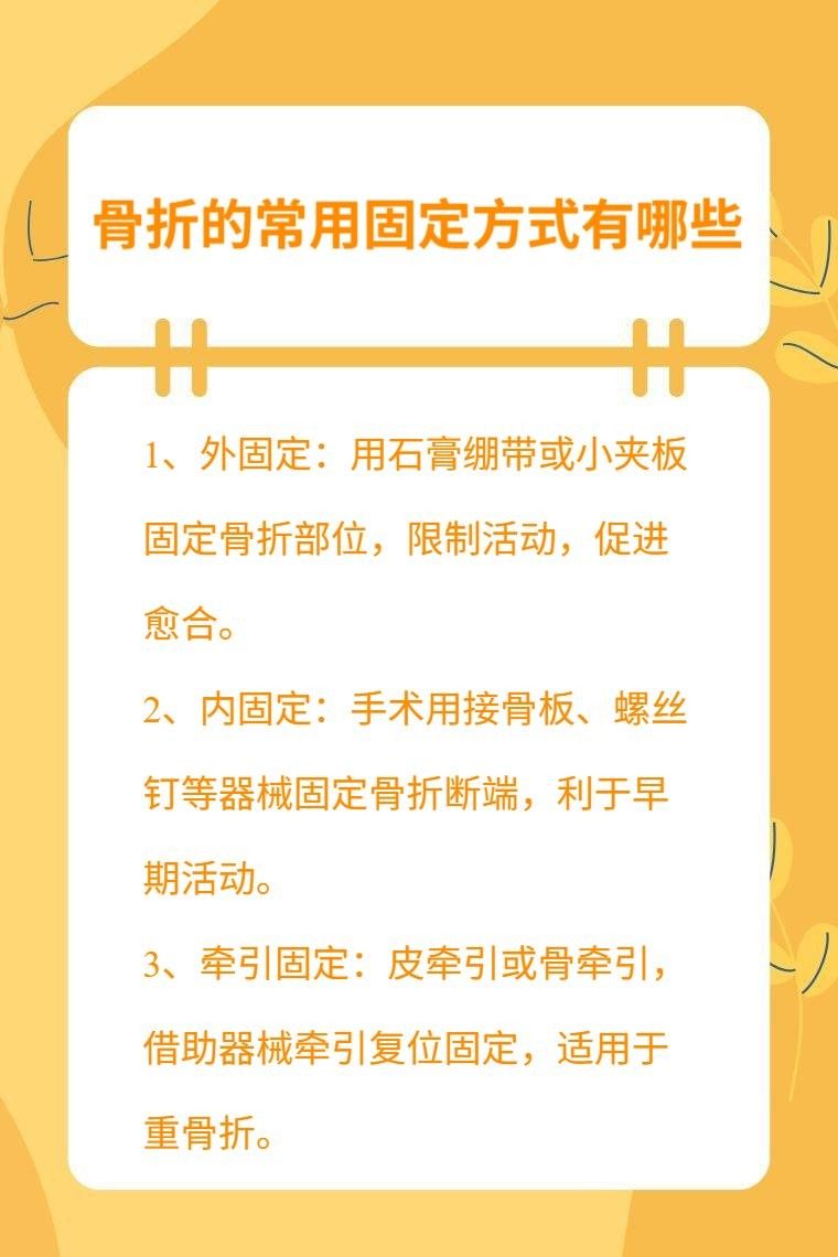 哪種固定方式最牢固？：哪種固定方式最牢固