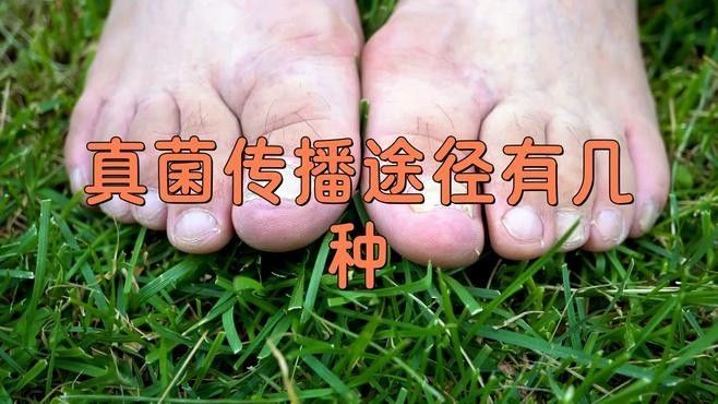 白毛感染會傳染嗎：白毛感染是否具有傳染性