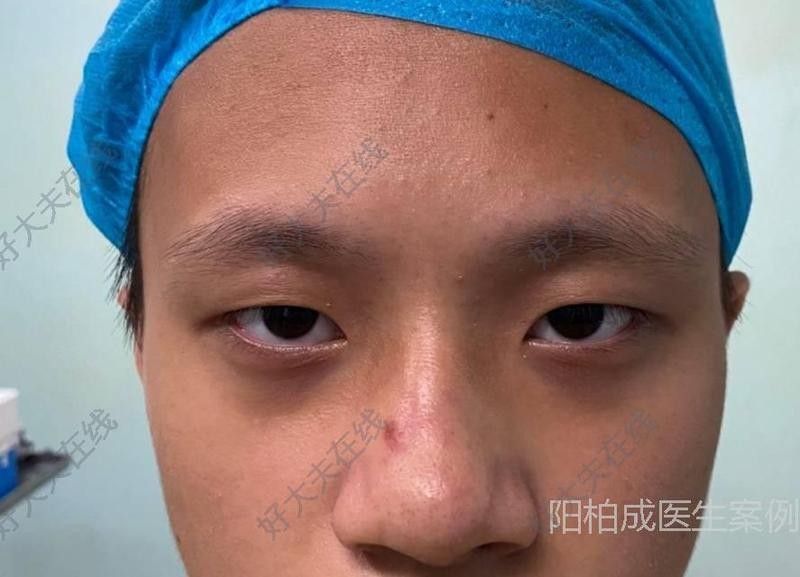 廈門(mén)哪家醫(yī)院有龍魚(yú)手術(shù)案例？：廈門(mén)大學(xué)附屬第二醫(yī)院、廈門(mén)大學(xué)附屬第二醫(yī)院龍魚(yú)手術(shù)
