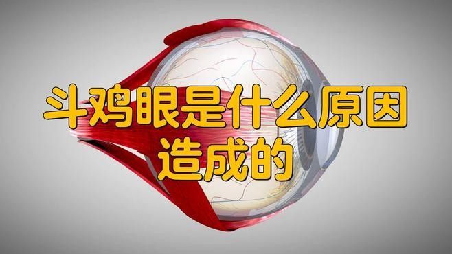 后天形成的鉆石眼如何治療：后天性白內障的治療方法