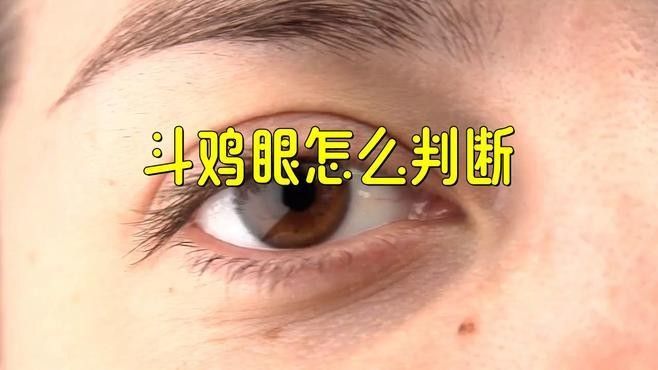 后天形成的鉆石眼如何治療：后天性白內障的治療方法
