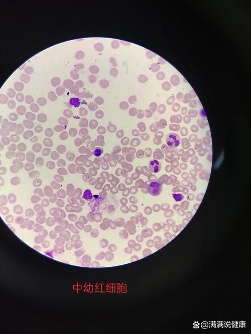 紅龍魚鱗片顯微結構圖有哪些？：紅龍魚鱗片顯微結構的多個方面包括鱗片的基本構造、色素沉積、紋理特征