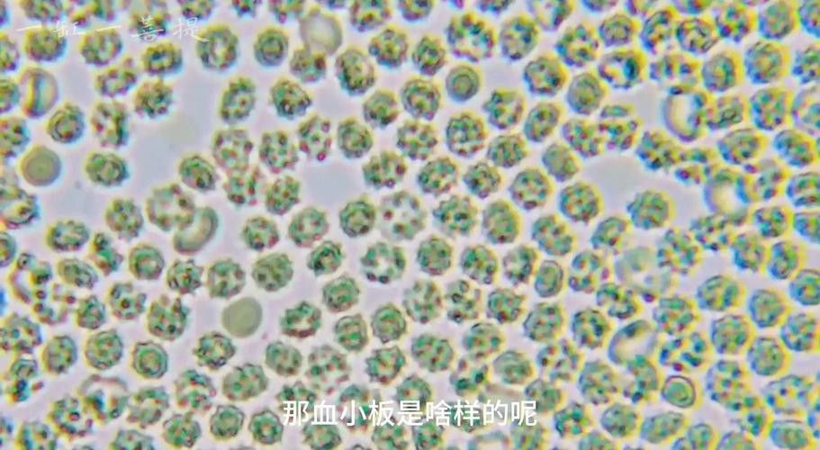 紅龍魚鱗片顯微結構圖有哪些？：紅龍魚鱗片顯微結構的多個方面包括鱗片的基本構造、色素沉積、紋理特征