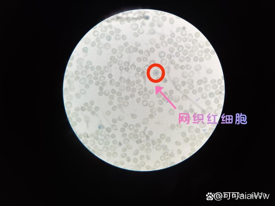 紅龍魚鱗片顯微結構圖有哪些？：紅龍魚鱗片顯微結構的多個方面包括鱗片的基本構造、色素沉積、紋理特征
