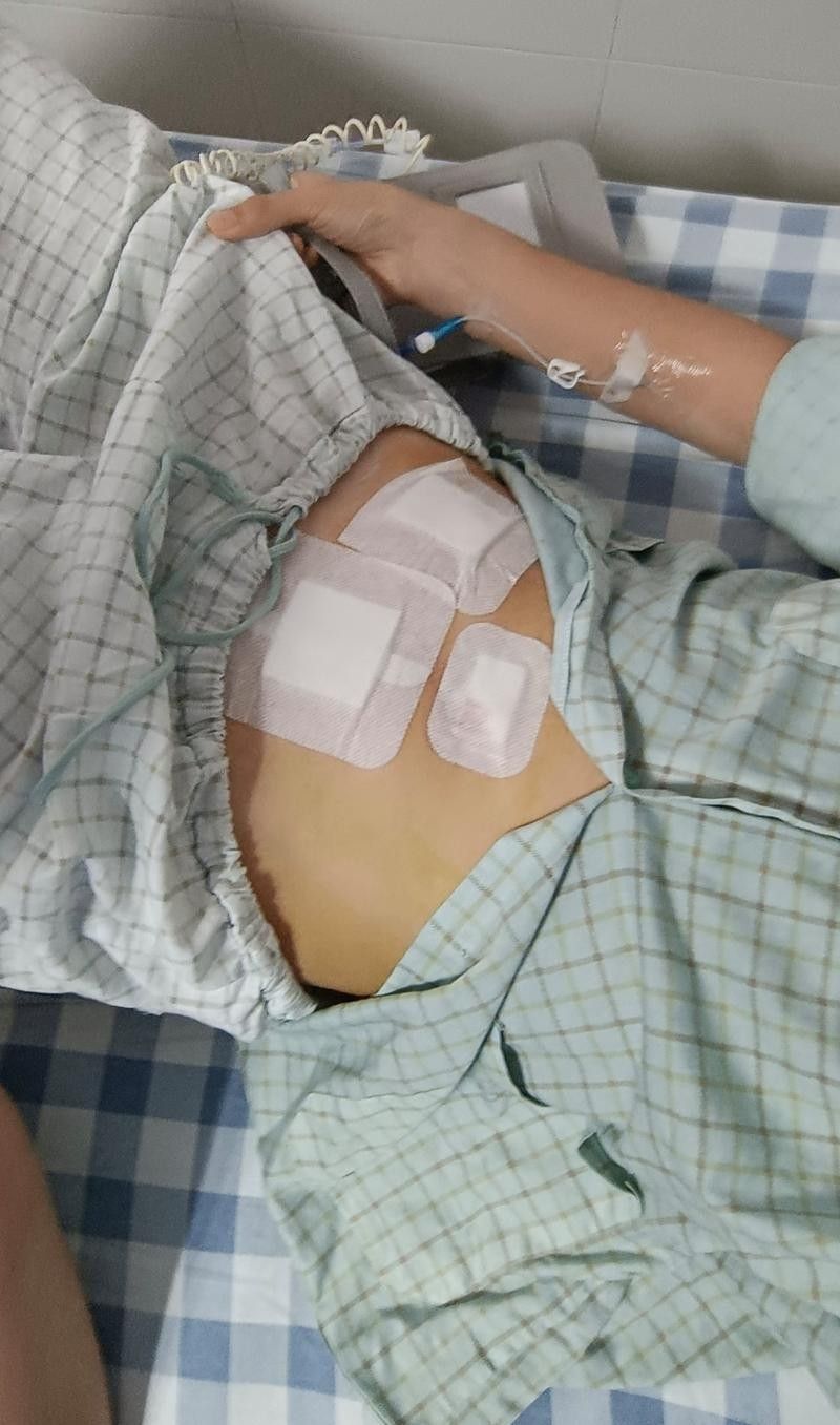 爛尾手術后如何預防感染？（南陽醫專一附院闌尾炎手術后的護理）