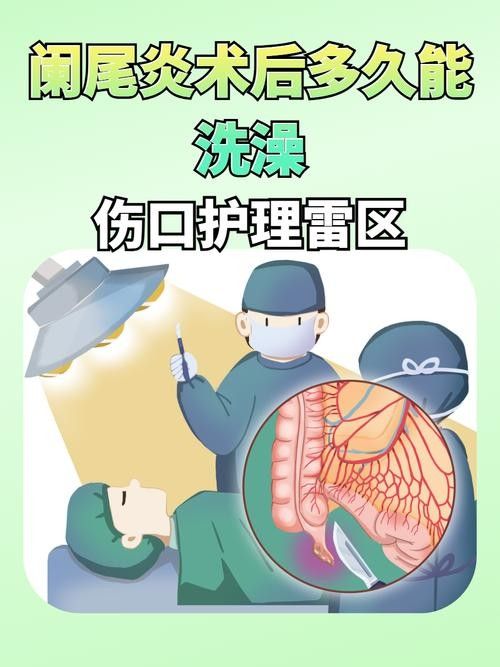 爛尾手術后如何預防感染？（南陽醫專一附院闌尾炎手術后的護理）