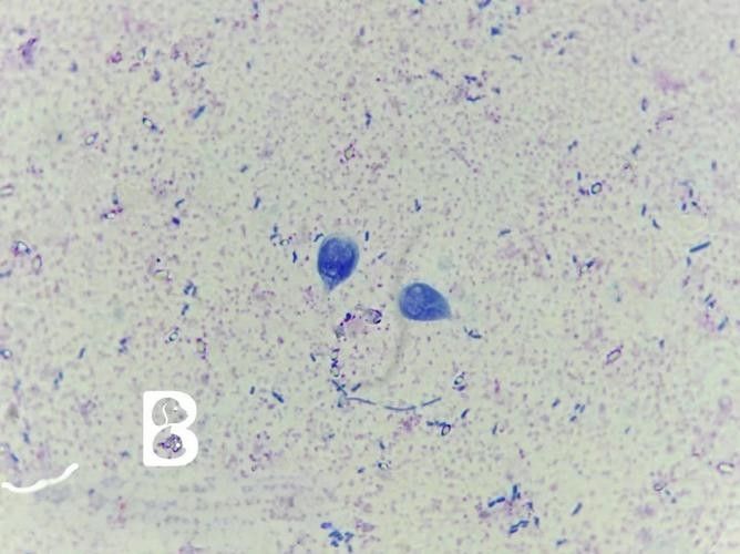 如何預防龍貓感染賈第鞭毛蟲？（如何預防龍貓感染賈第鞭毛蟲）