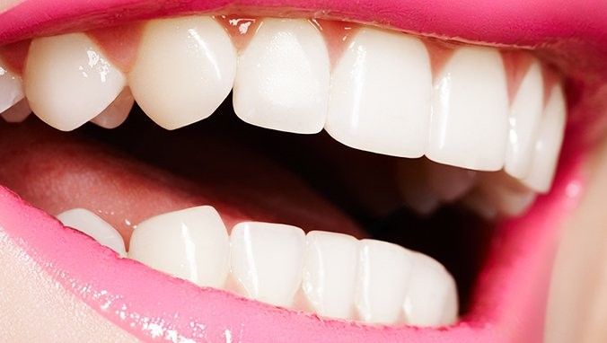 非手術(shù)矯正多久見效（牙齒矯正多久能看到效果） 非手術(shù)矯正多久見效（牙齒矯正多久能看到效果） 龍魚百科 第7張