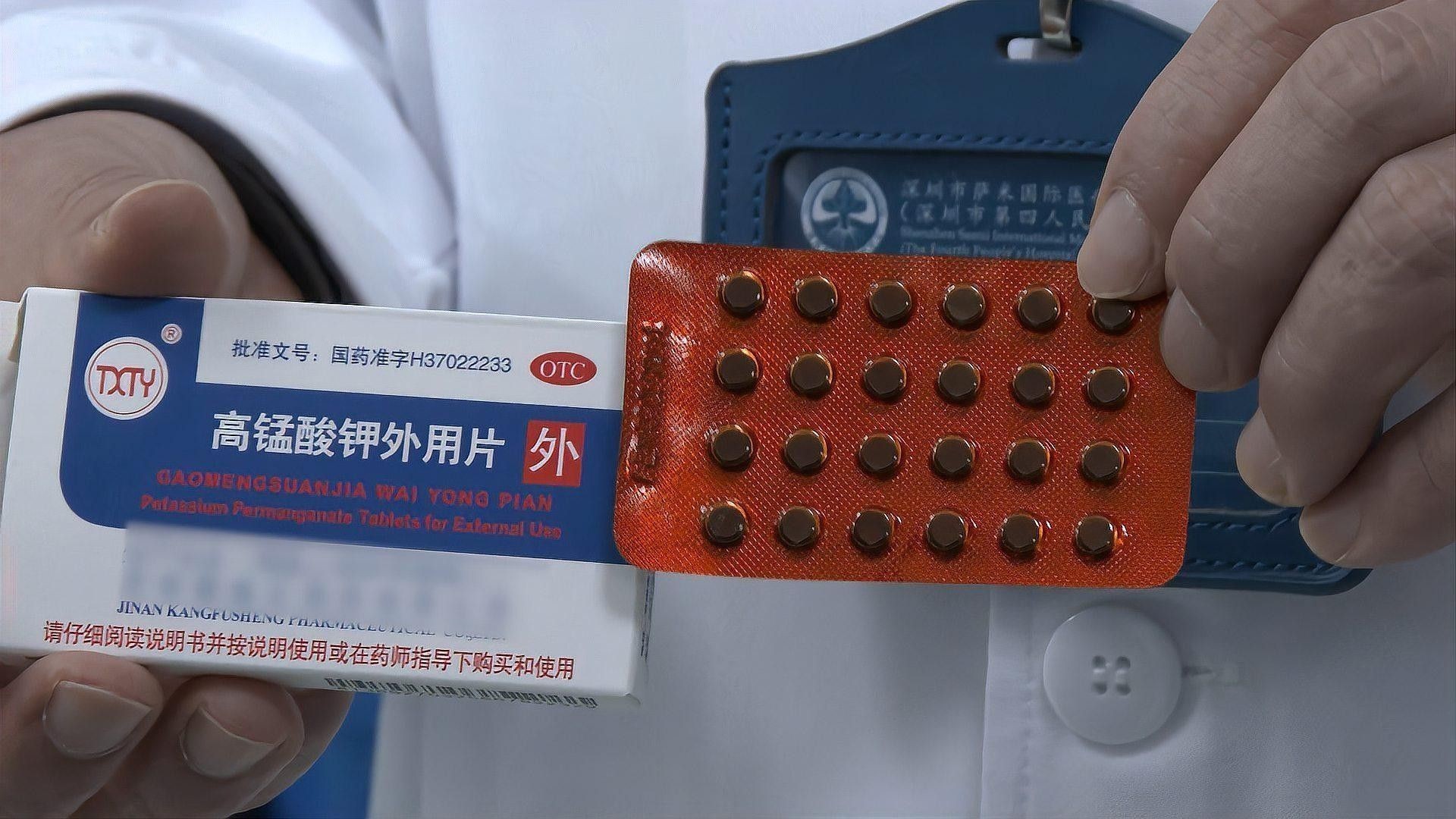 高錳酸鉀中毒后如何急救？（高錳酸鉀中毒如何急救）