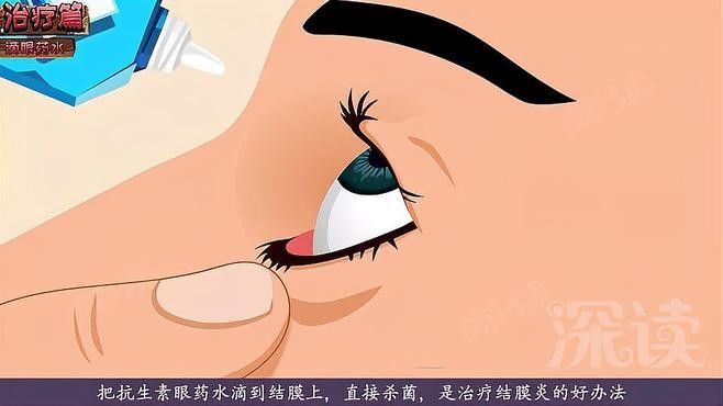 紅龍蒙眼病如何治療（治療紅龍蒙眼病的方法主要包括以下幾個方面以下幾個方面）