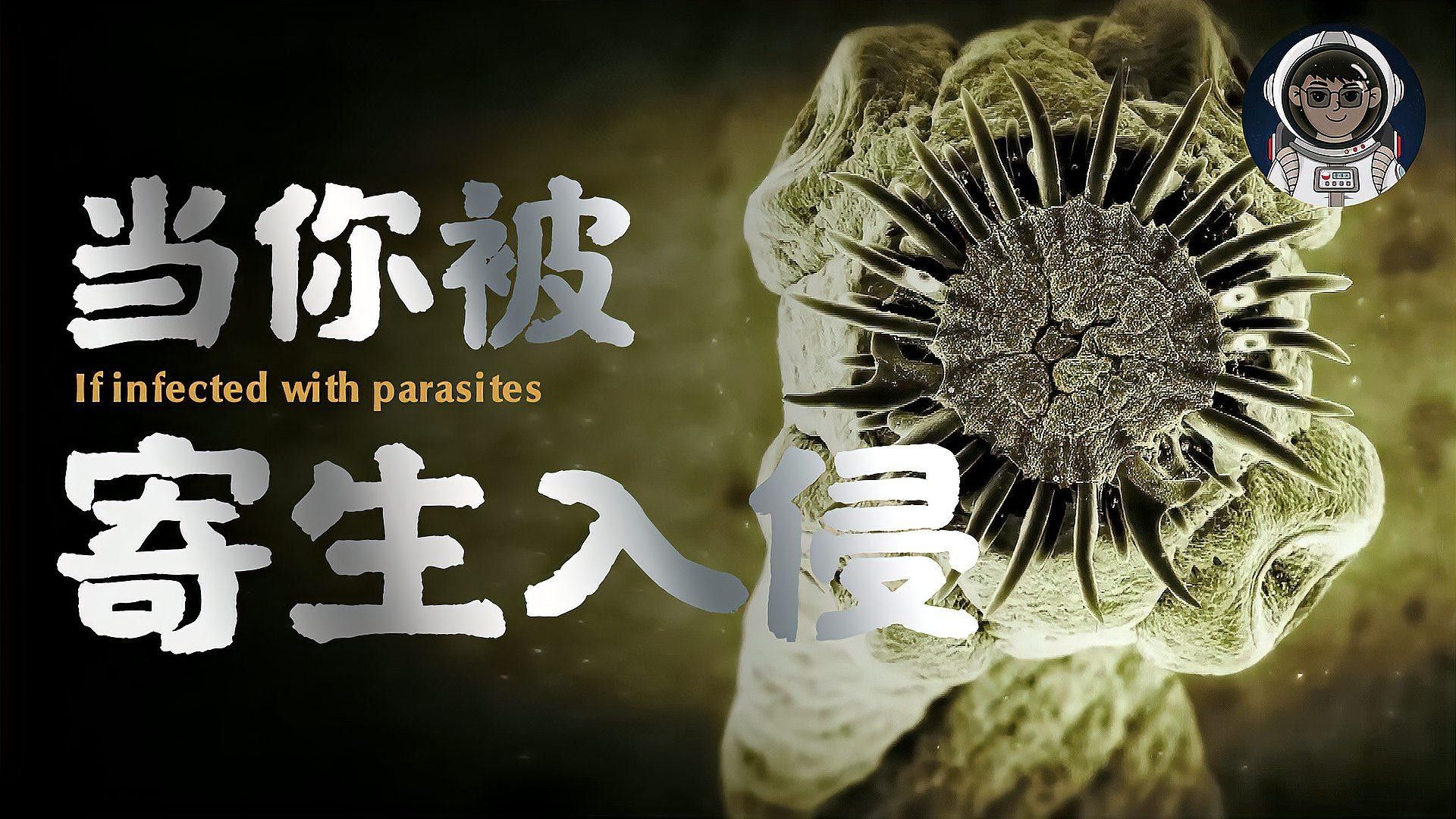 寄生蟲感染如何預(yù)防和治療 寄生蟲感染如何預(yù)防和治療 龍魚百科 第1張