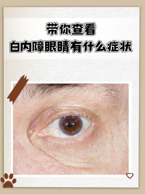 如何判斷鉆石眼是否嚴重？（判斷鉆石眼是否嚴重需要綜合考慮多個因素，眼科醫生綜合評估） 如何判斷鉆石眼是否嚴重？（判斷鉆石眼是否嚴重需要綜合考慮多個因素，眼科醫生綜合評估） 龍魚百科 第2張