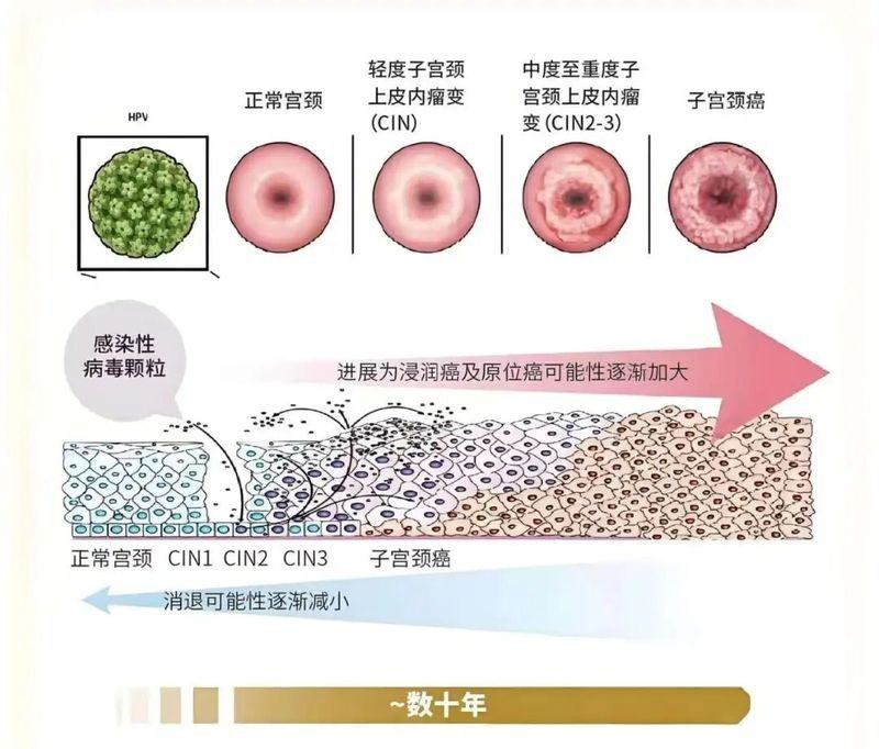 輕微立鱗會自愈嗎？（關(guān)于魚類鱗片損傷的問題）