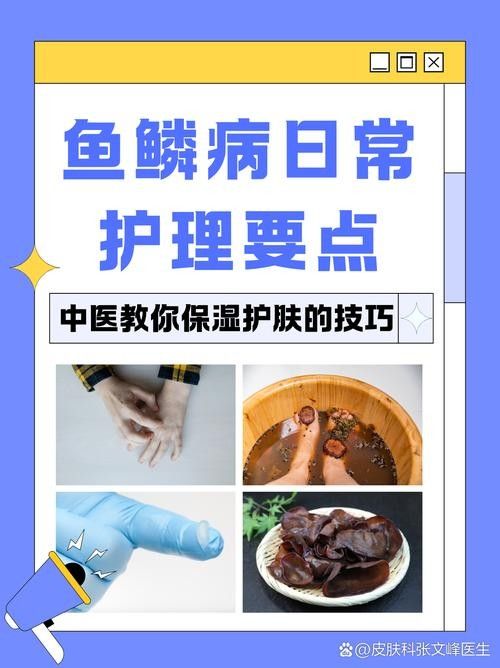 如何預防松鱗病的復發（如何預防松鱗病復發） 如何預防松鱗病的復發（如何預防松鱗病復發） 龍魚百科 第3張