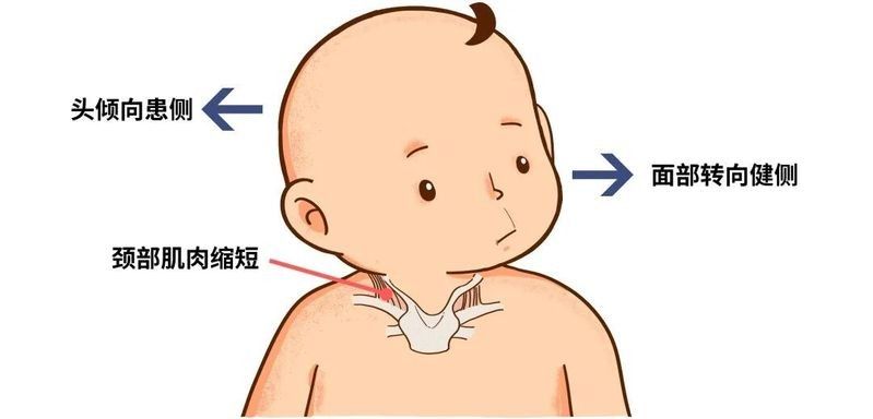 龍頭歪斜矯正手術(shù)風(fēng)險大嗎？（龍頭歪斜矯正手術(shù)有哪些風(fēng)險）
