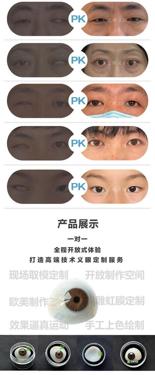 哪種材質(zhì)的義眼最好？