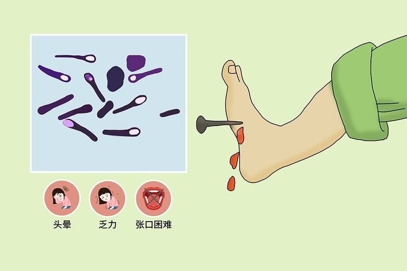 如何預(yù)防破傷風(fēng)感染？（主任醫(yī)師三甲如何防治破傷風(fēng)）