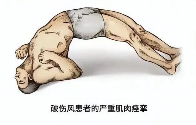 TAT和TIG的區別是什么？