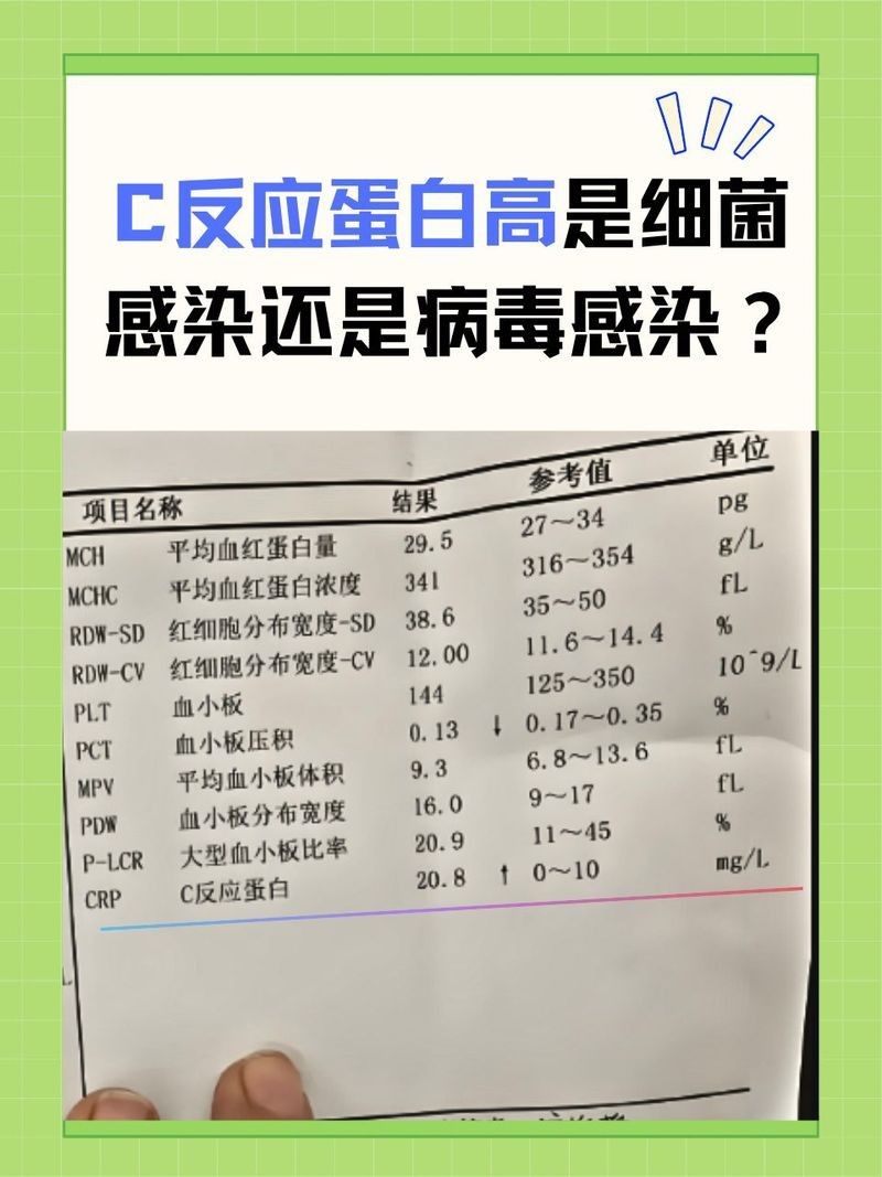 如何區(qū)分細(xì)菌感染和病毒感染